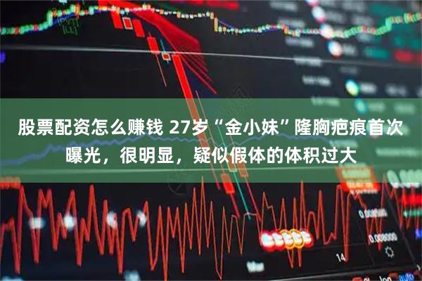 股票配资怎么赚钱 27岁“金小妹”隆胸疤痕首次曝光，很明显，疑似假体的体积过大